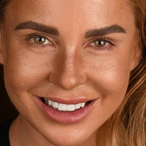 Smile shown in Walden Dental's patient gallery