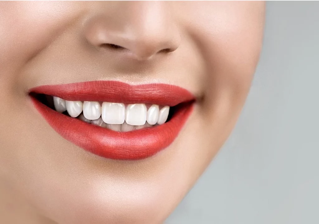 A bright smile representing teeth whitening